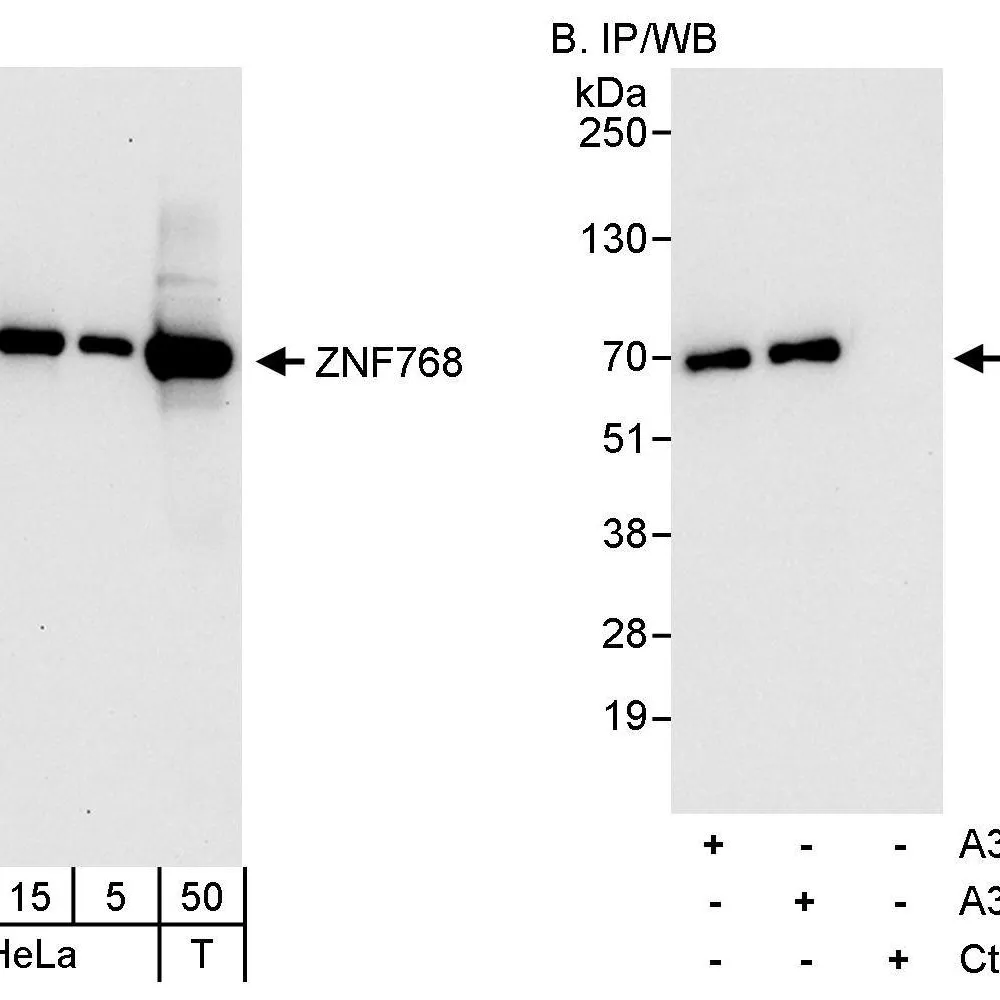 Rabbit anti-ZNF768 Antibody, Affinity Purified