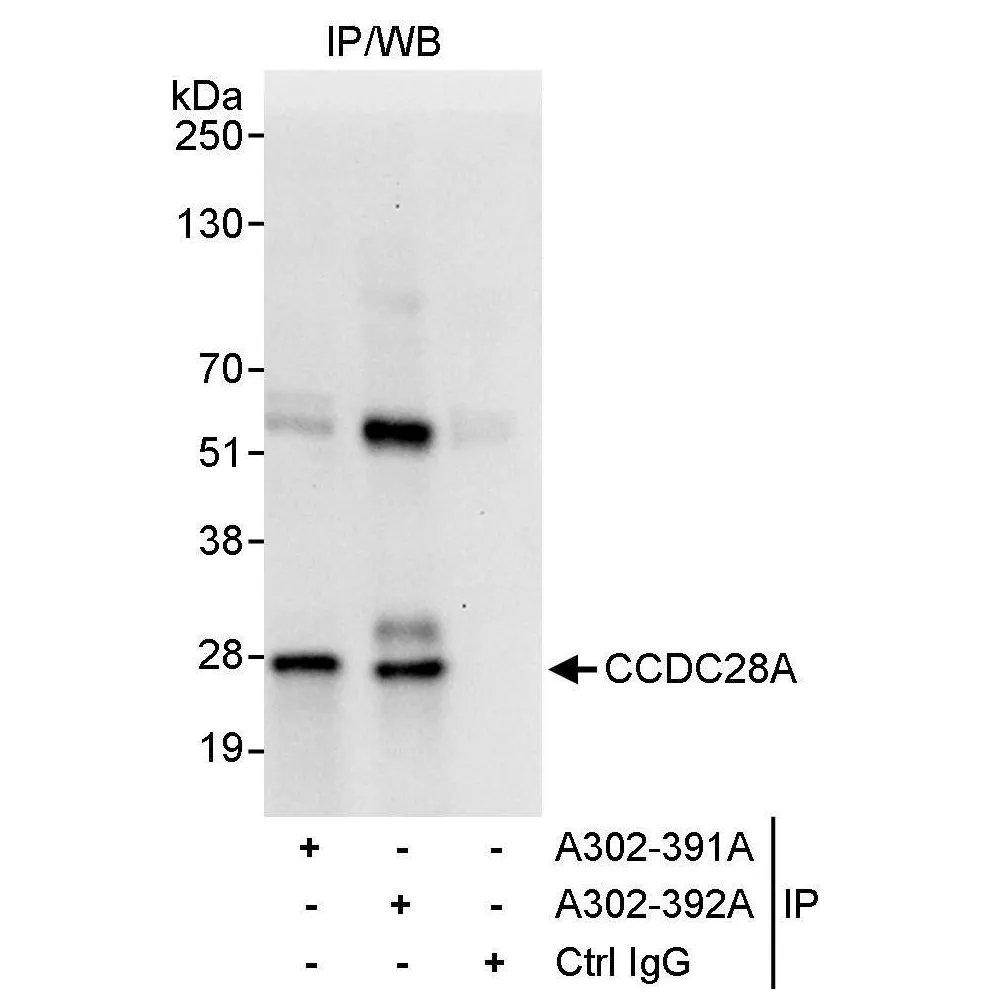 Rabbit anti-CCDC28A Antibody, Affinity Purified
