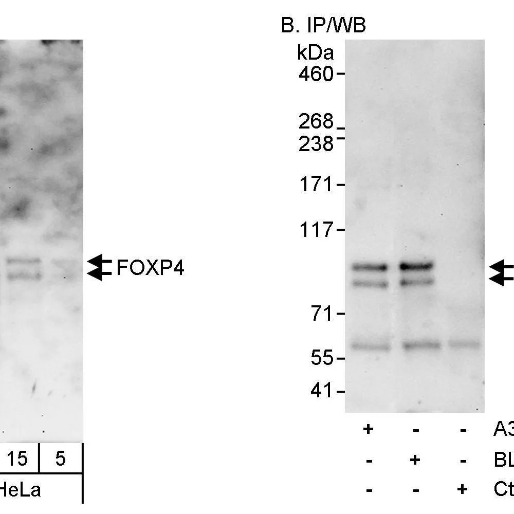 Rabbit anti-FOXP4 Antibody, Affinity Purified