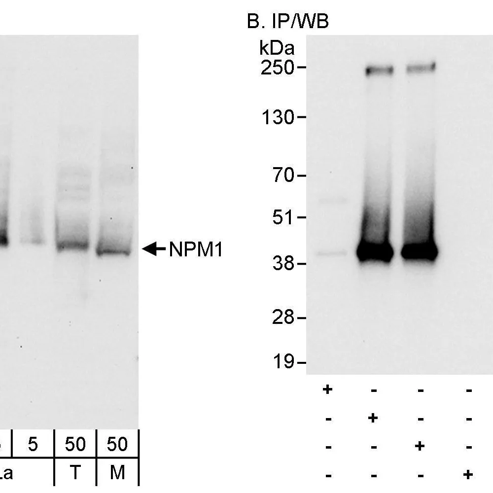 Rabbit anti-NPM1 Antibody, Affinity Purified