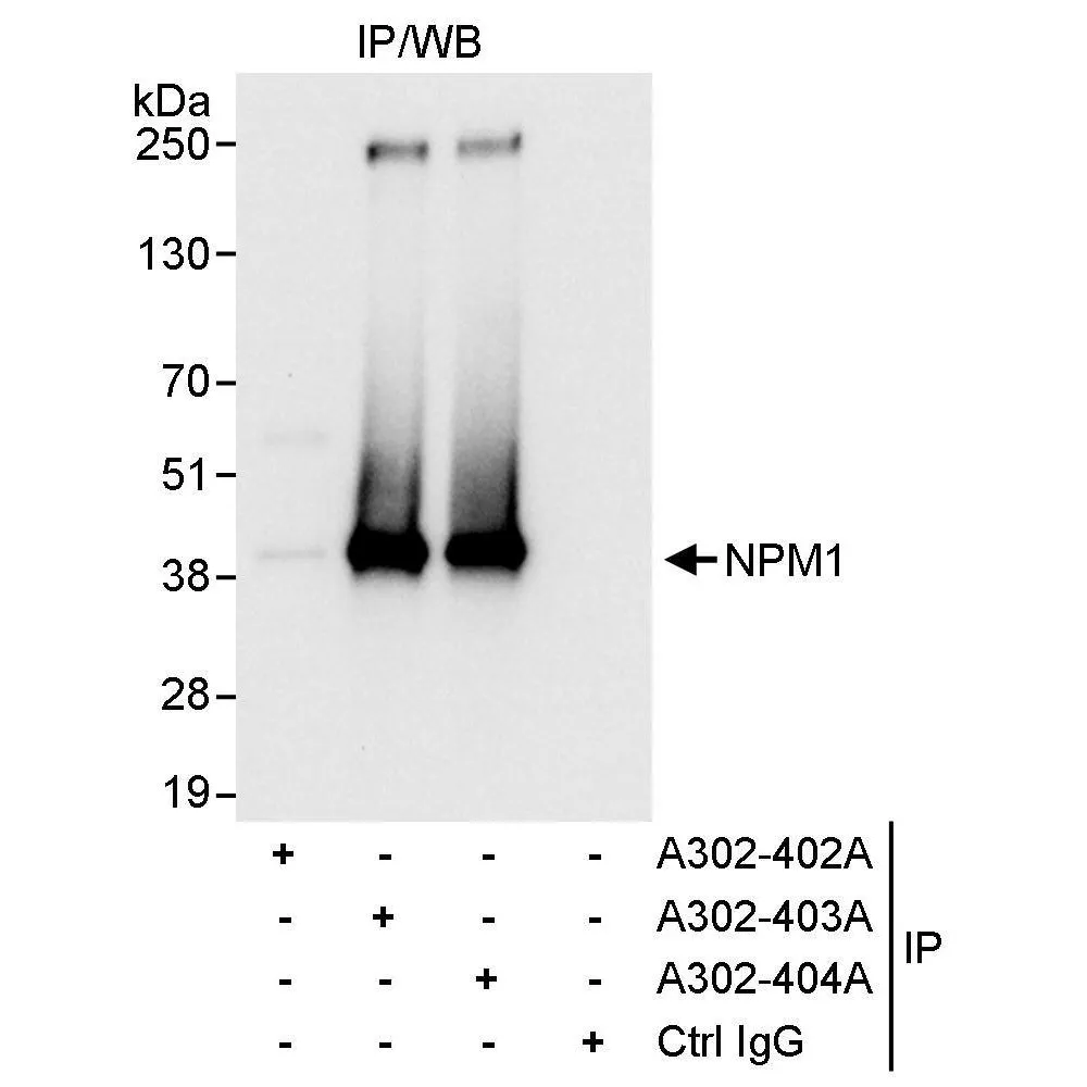 Rabbit anti-NPM1 Antibody, Affinity Purified