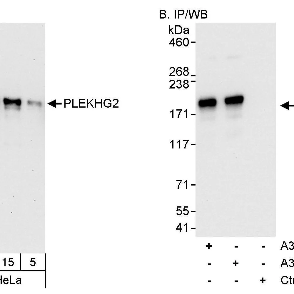 Rabbit anti-PLEKHG2 Antibody, Affinity Purified