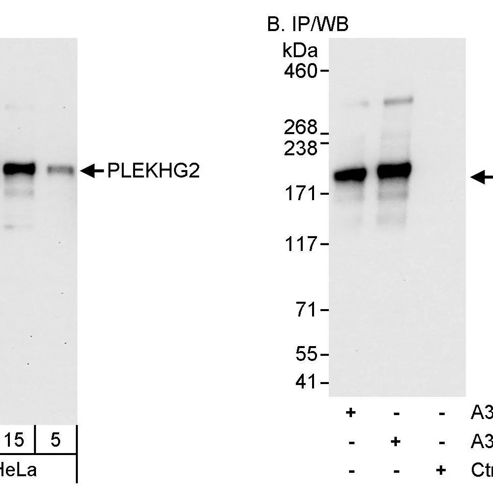 Rabbit anti-PLEKHG2 Antibody, Affinity Purified