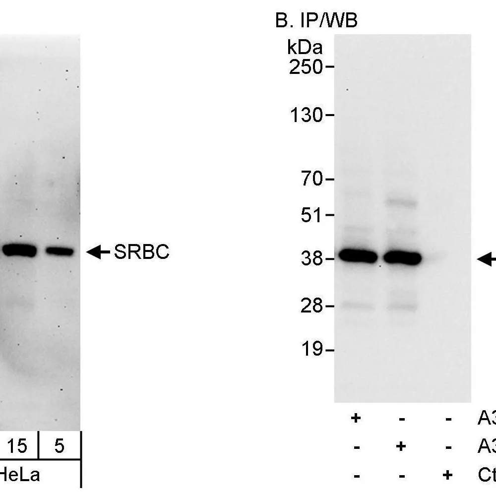 Rabbit anti-SRBC Antibody, Affinity Purified