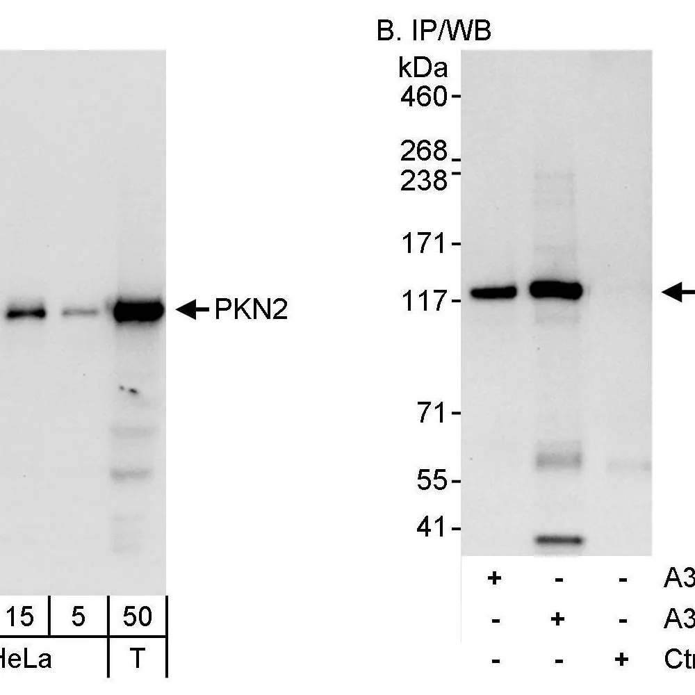 Rabbit anti-PKN2 Antibody, Affinity Purified