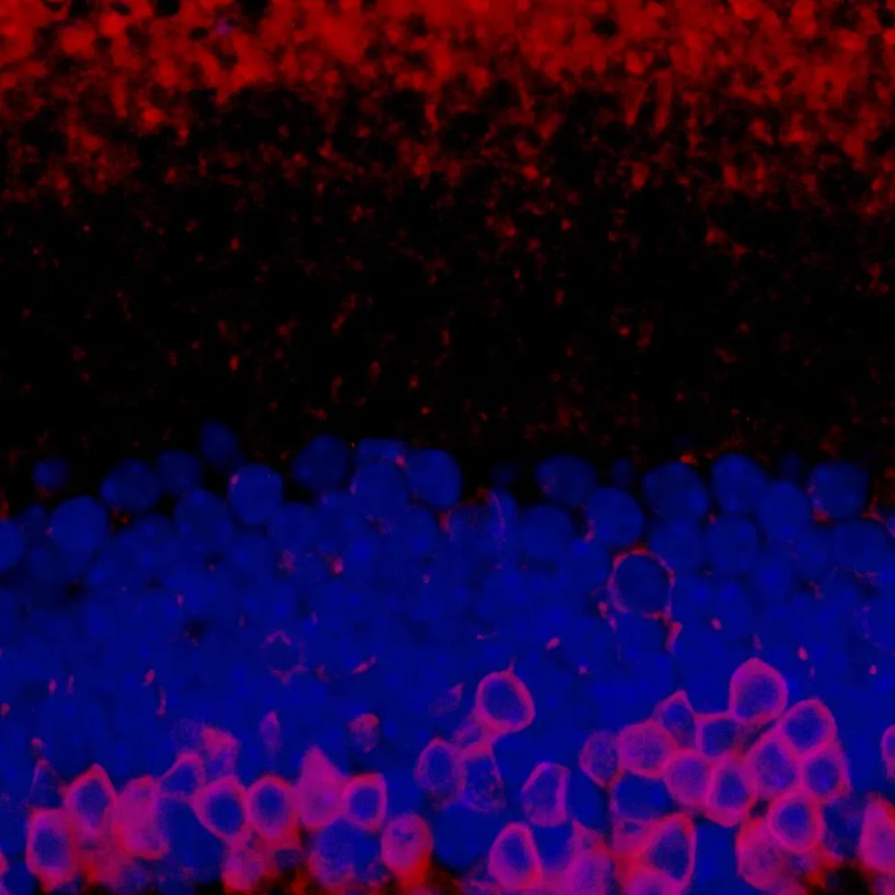 Rabbit anti-PKC-alpha Antibody, Affinity Purified
