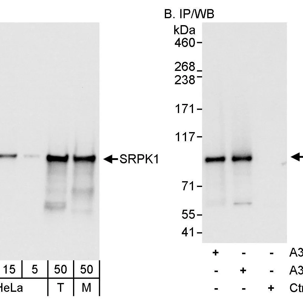 Rabbit anti-SRPK1 Antibody, Affinity Purified