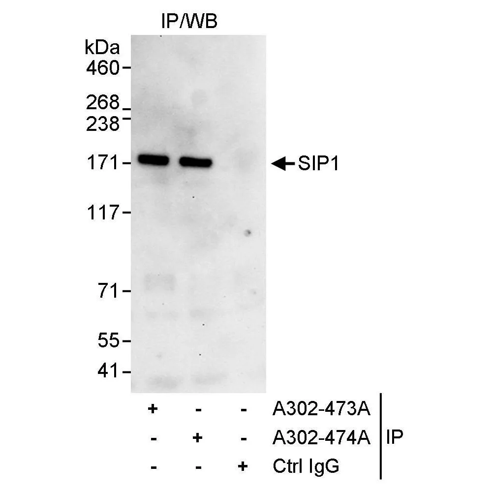 Rabbit anti-ZEB2/SIP Antibody, Affinity Purified