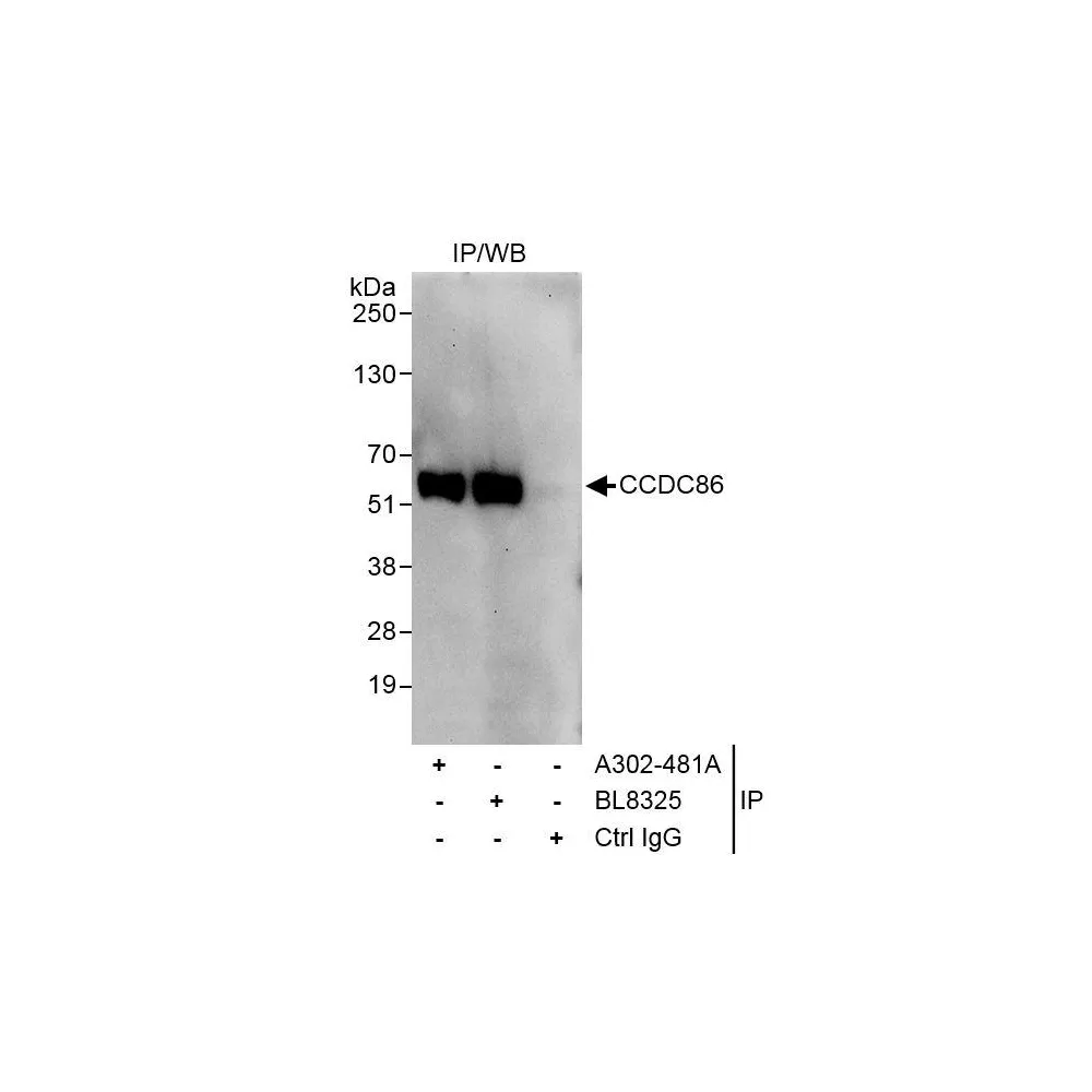 Rabbit anti-CCDC86 Antibody, Affinity Purified