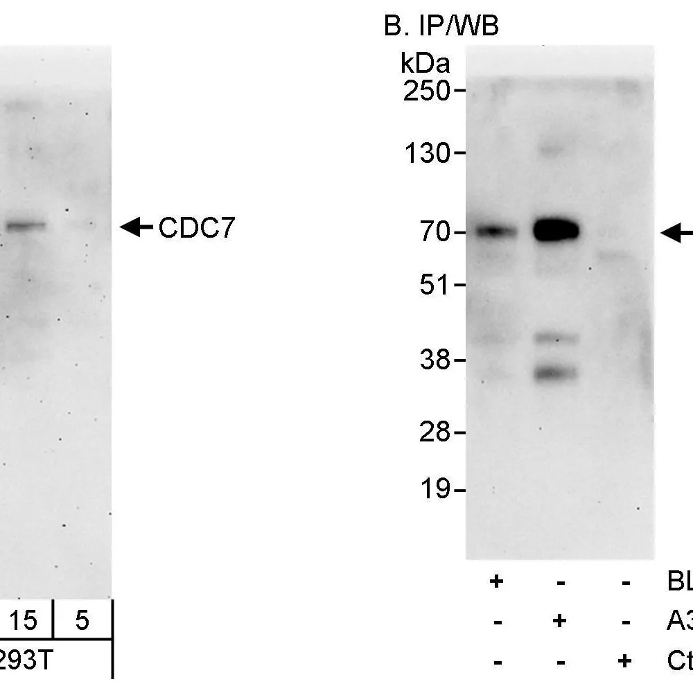 Rabbit anti-CDC7 Antibody, Affinity Purified