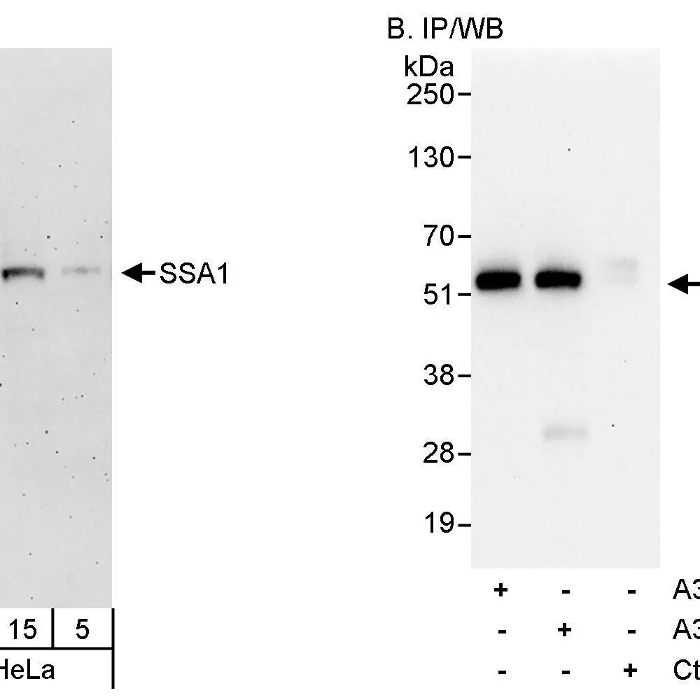 Rabbit anti-SSA1 Antibody, Affinity Purified