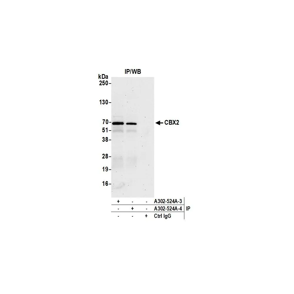 Rabbit anti-CBX2 Antibody, Affinity Purified