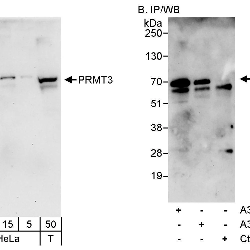 Rabbit anti-PRMT3 Antibody, Affinity Purified