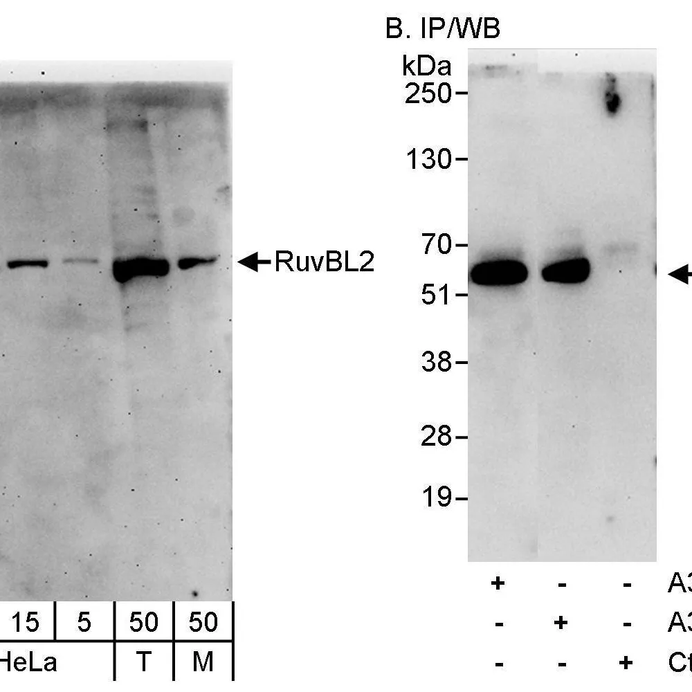 Rabbit anti-RuvBL2 Antibody, Affinity Purified