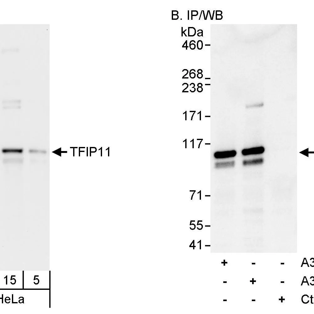 Rabbit anti-TFIP11 Antibody, Affinity Purified