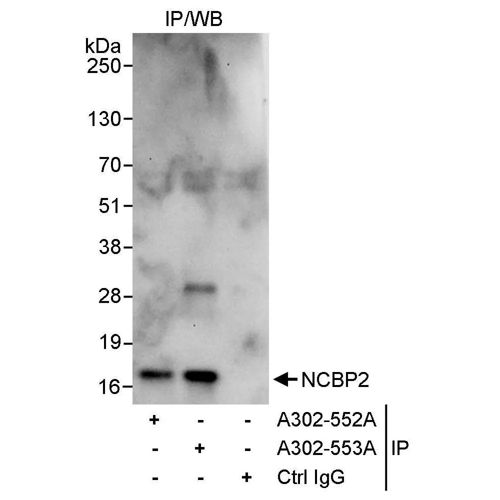 Rabbit anti-NCBP2 Antibody, Affinity Purified