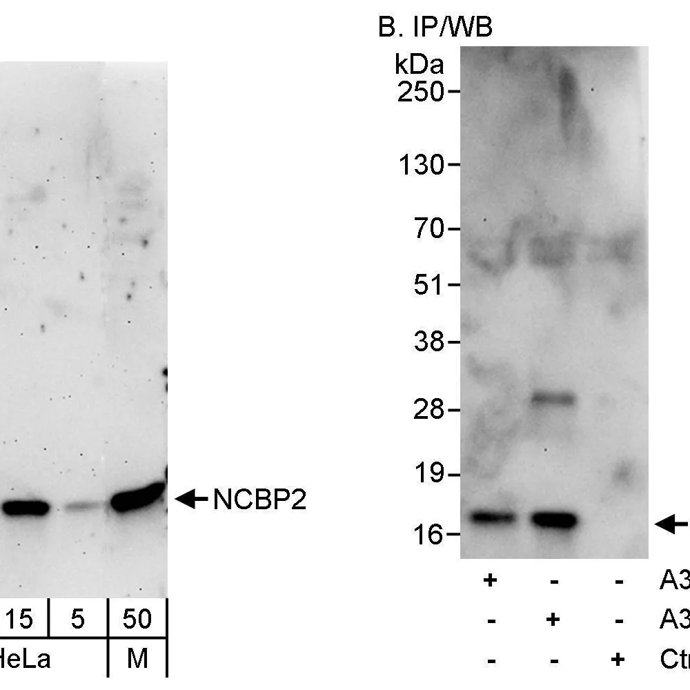 Rabbit anti-NCBP2 Antibody, Affinity Purified