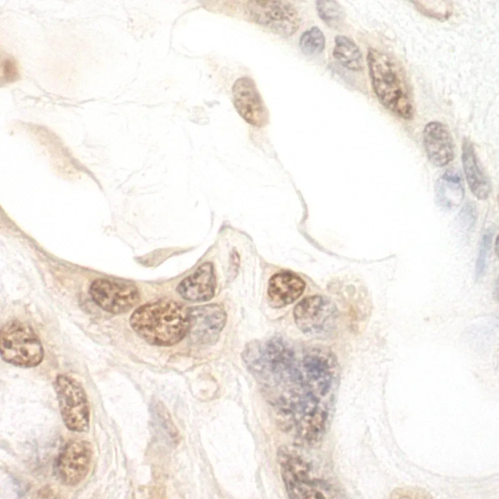 Rabbit anti-eIF2B5 Antibody, Affinity Purified