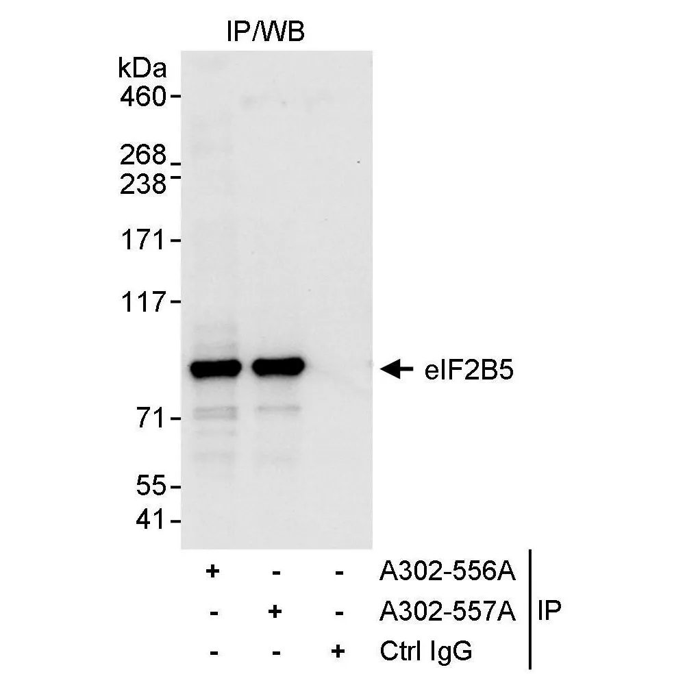 Rabbit anti-eIF2B5 Antibody, Affinity Purified