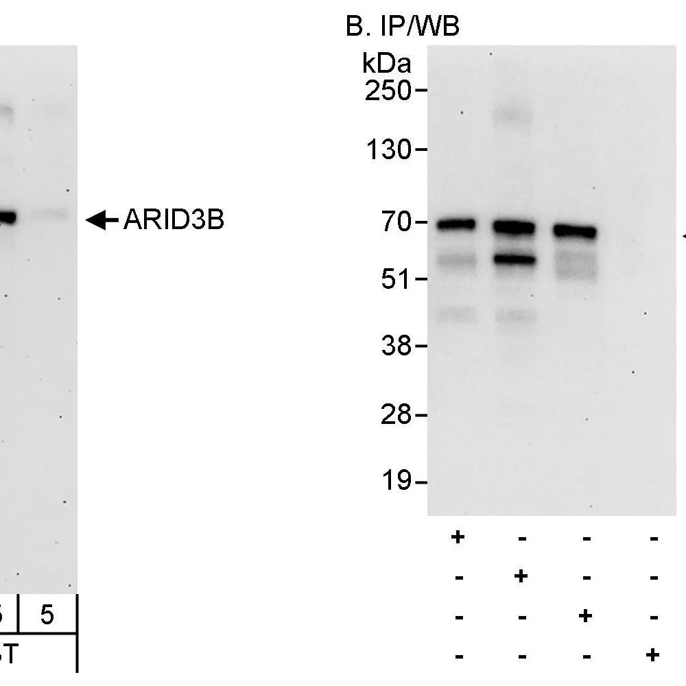 Rabbit anti-ARID3B Antibody, Affinity Purified