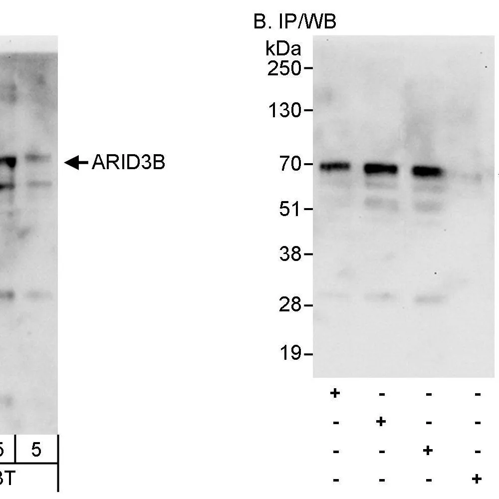 Rabbit anti-ARID3B Antibody, Affinity Purified