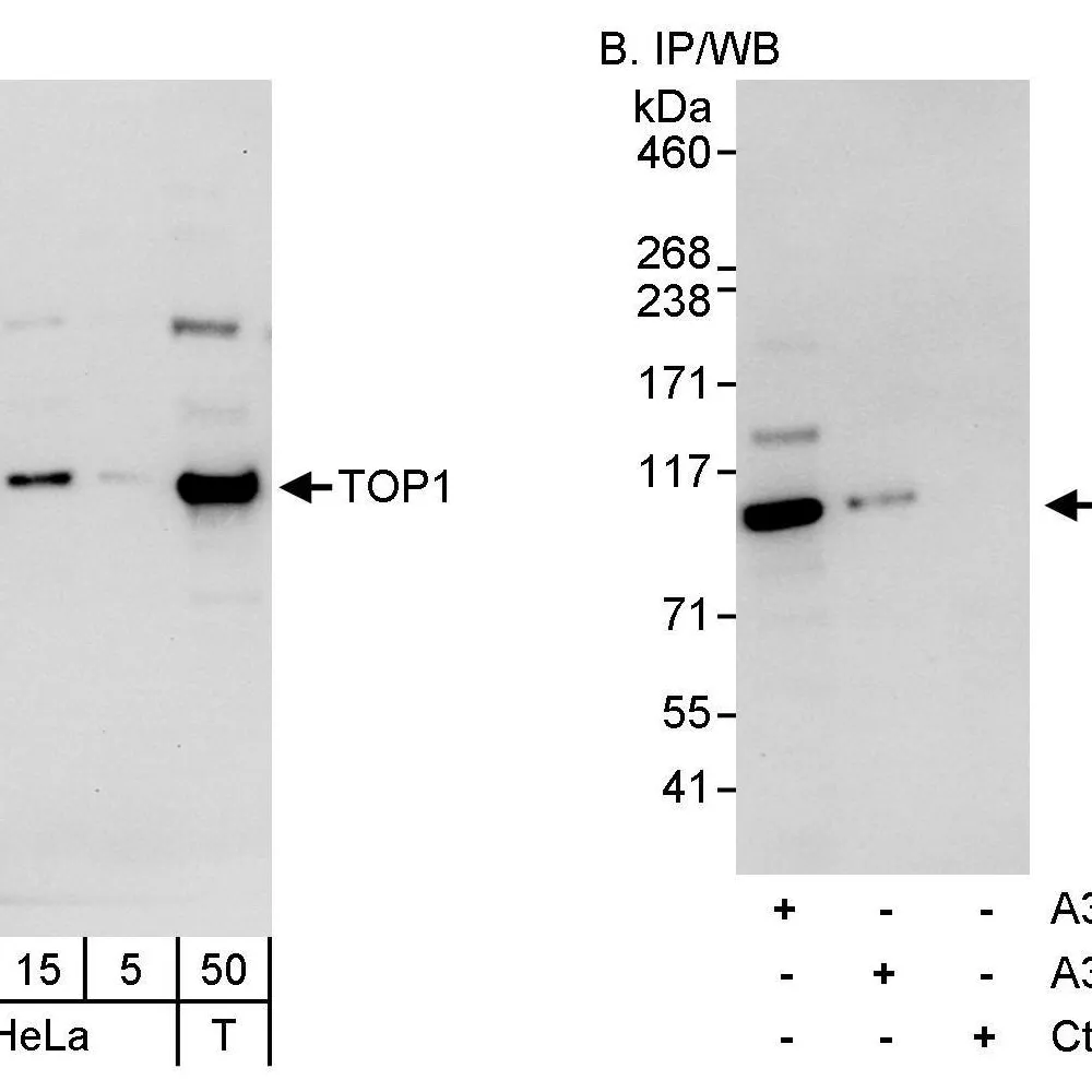 Rabbit anti-TOP1 Antibody, Affinity Purified
