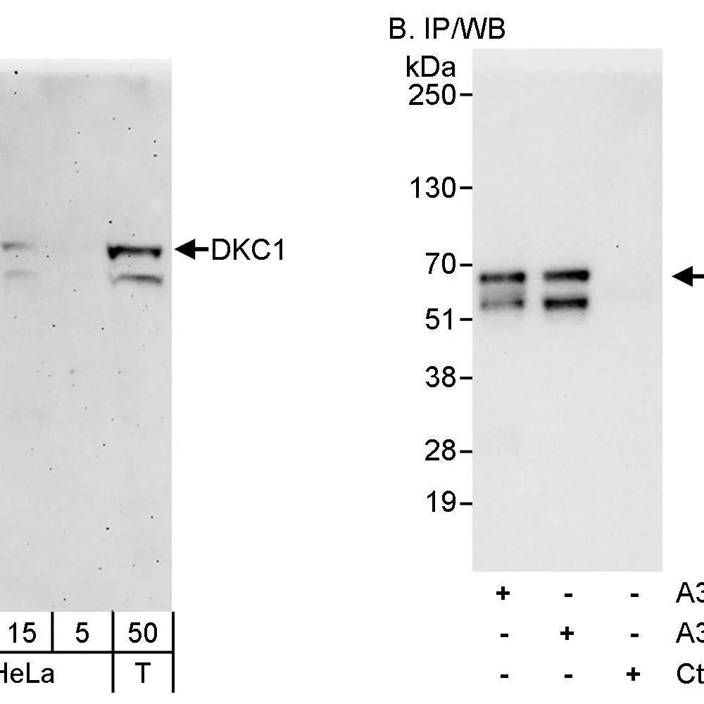 Rabbit anti-DKC1 Antibody, Affinity Purified