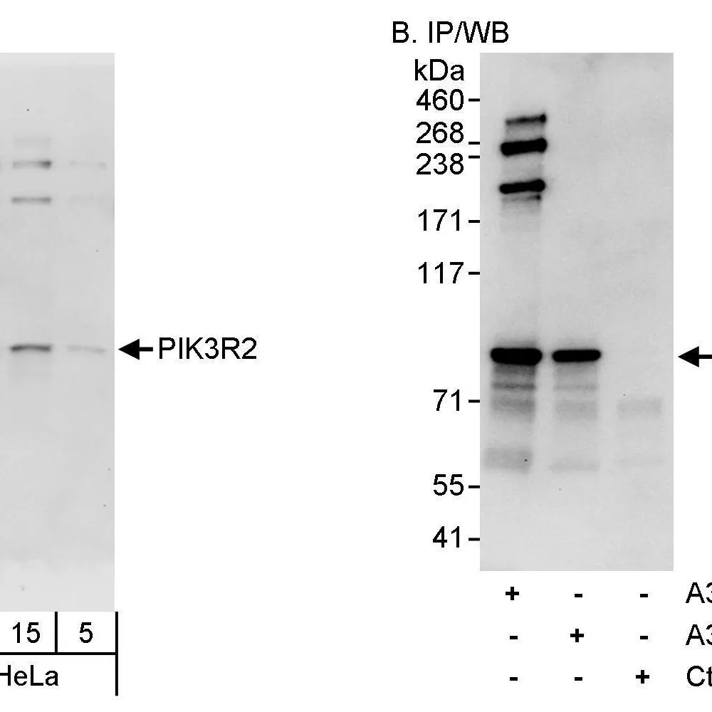 Rabbit anti-PIK3R2 Antibody, Affinity Purified