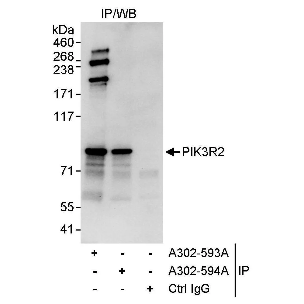 Rabbit anti-PIK3R2 Antibody, Affinity Purified