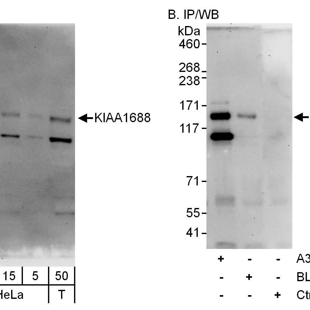 Rabbit anti-KIAA1688 Antibody, Affinity Purified