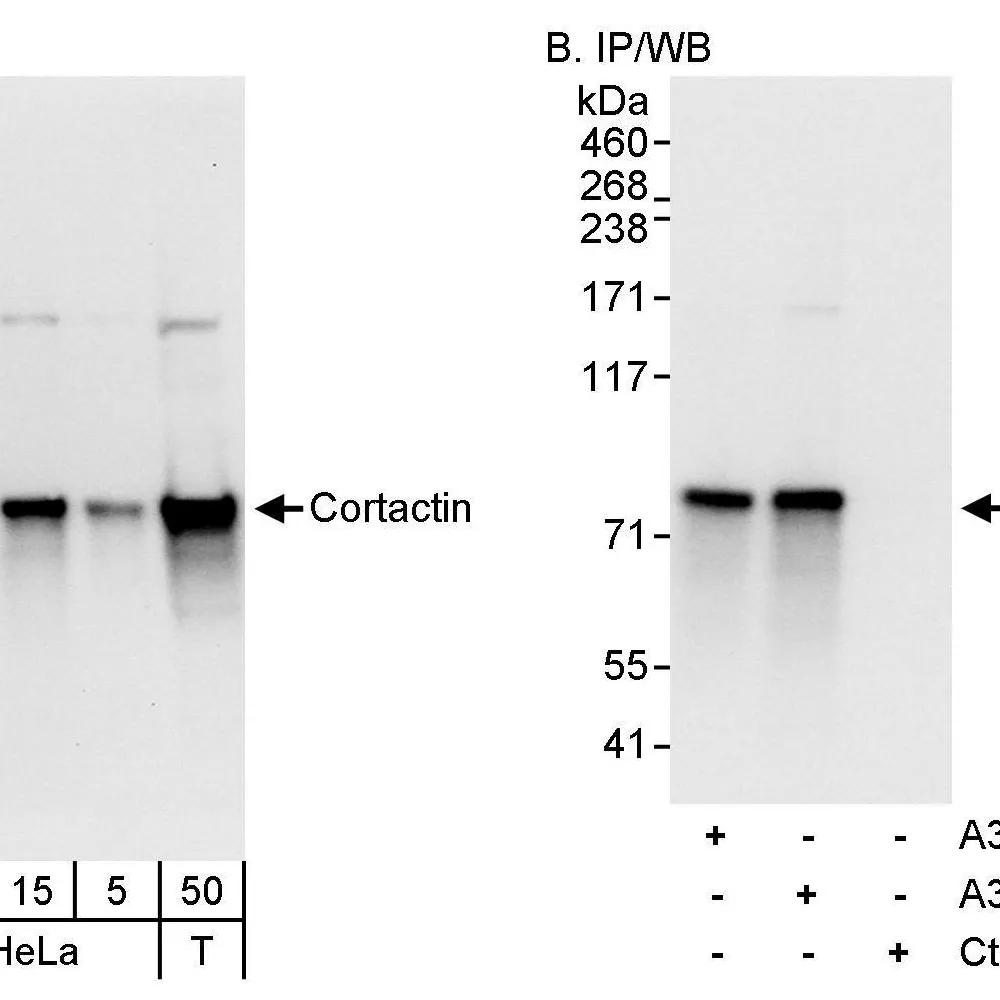 Rabbit anti-Cortactin Antibody, Affinity Purified