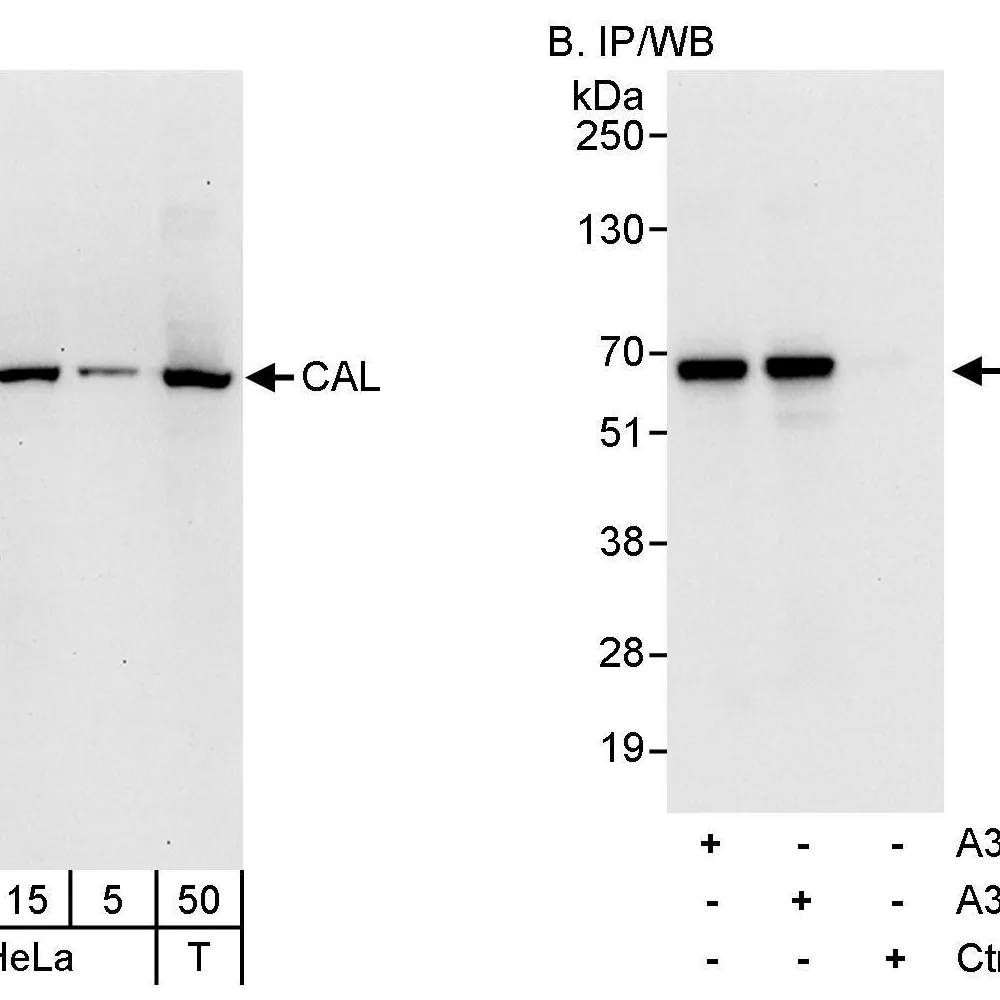 Rabbit anti-CAL Antibody, Affinity Purified