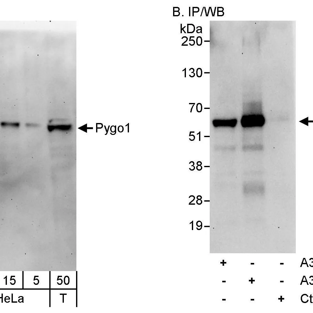 Rabbit anti-Pygo1 Antibody, Affinity Purified