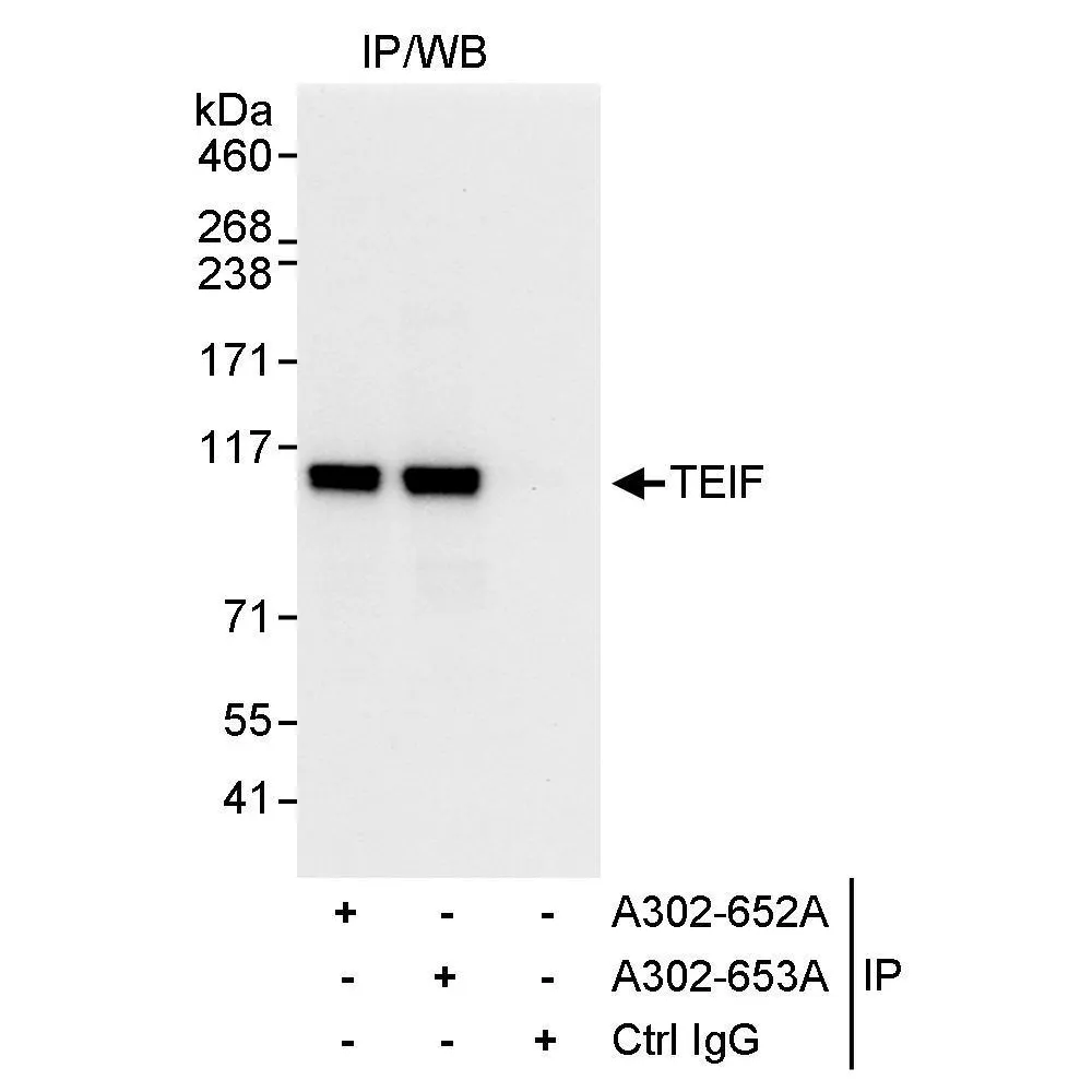 Rabbit anti-TEIF Antibody, Affinity Purified
