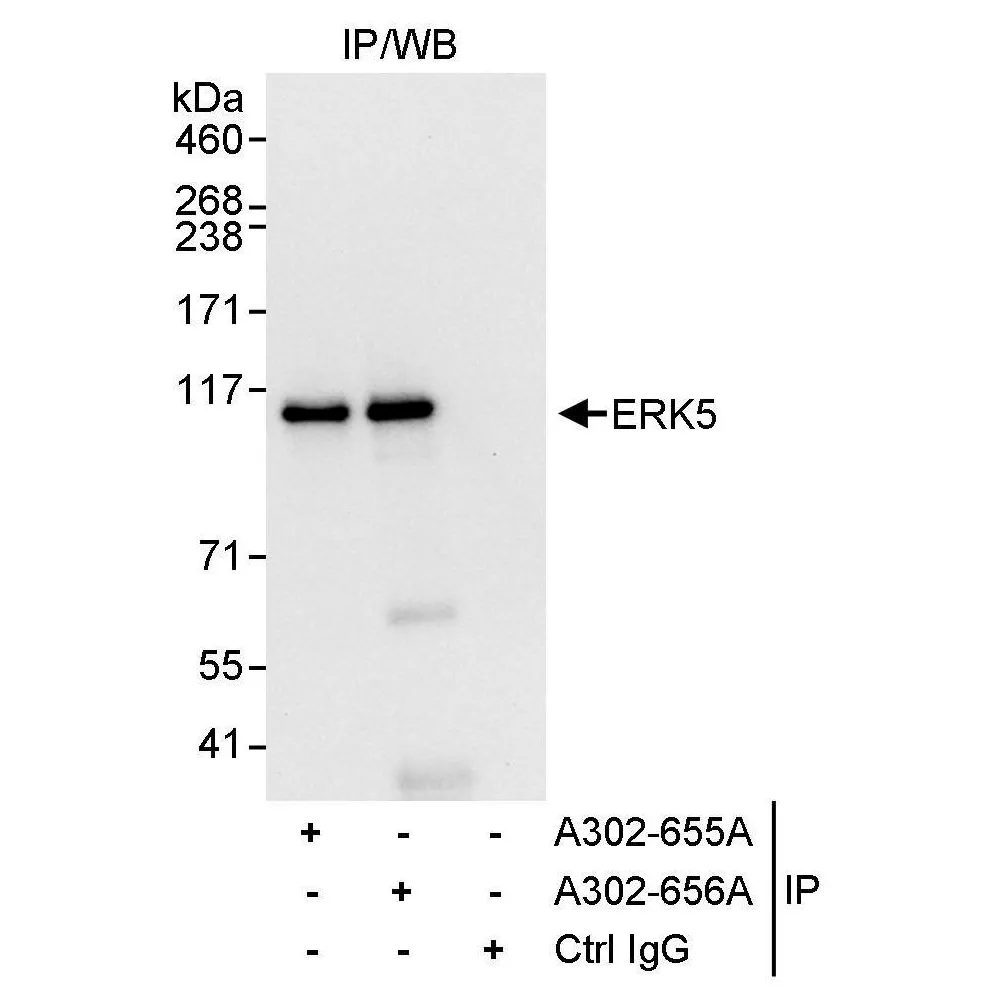 Rabbit anti-ERK5 Antibody, Affinity Purified