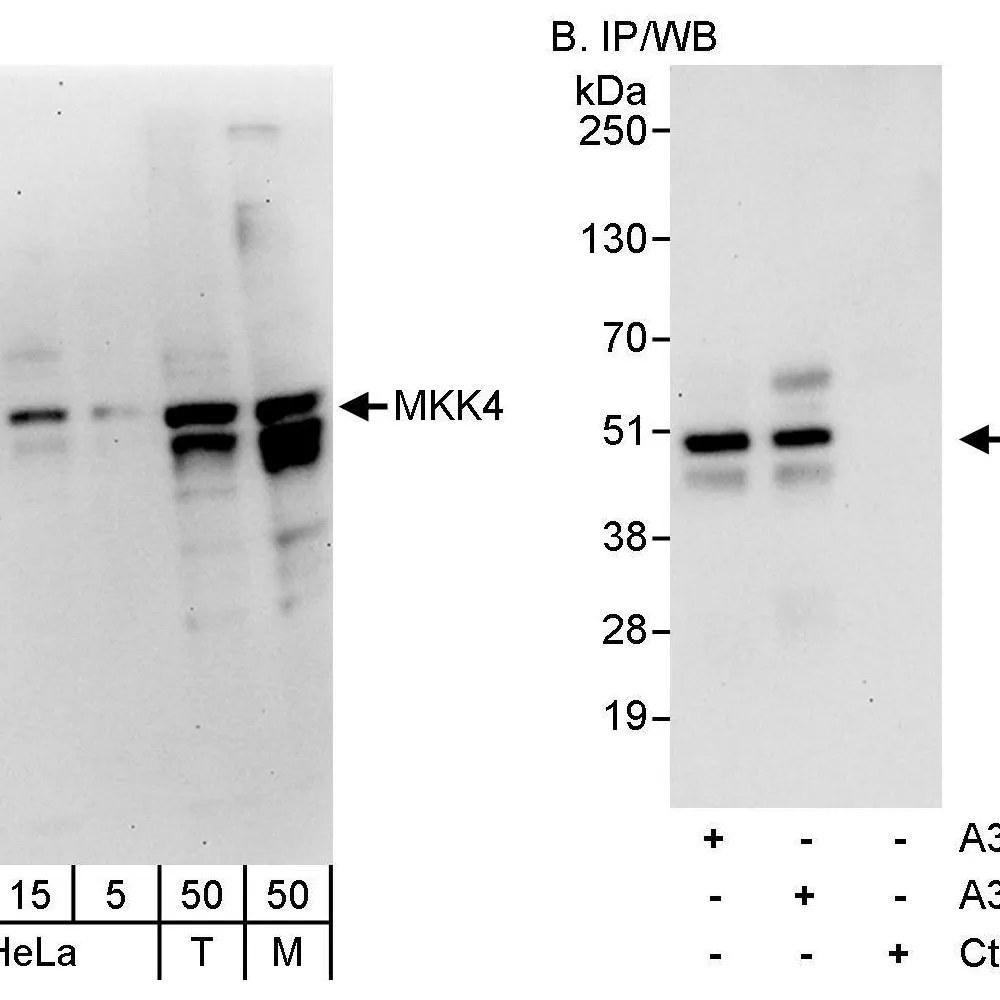 Rabbit anti-MKK4 Antibody, Affinity Purified
