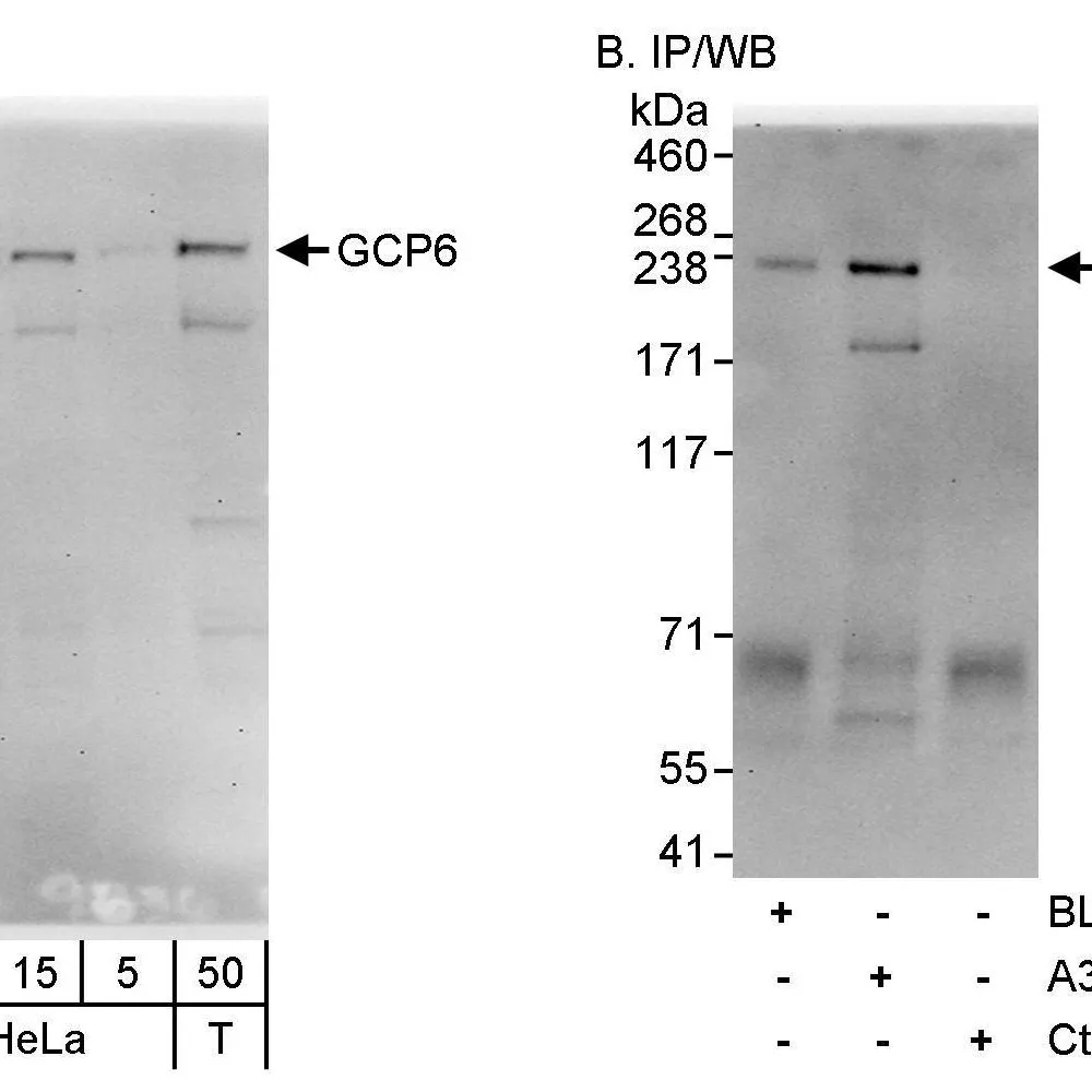 Rabbit anti-GCP6 Antibody, Affinity Purified