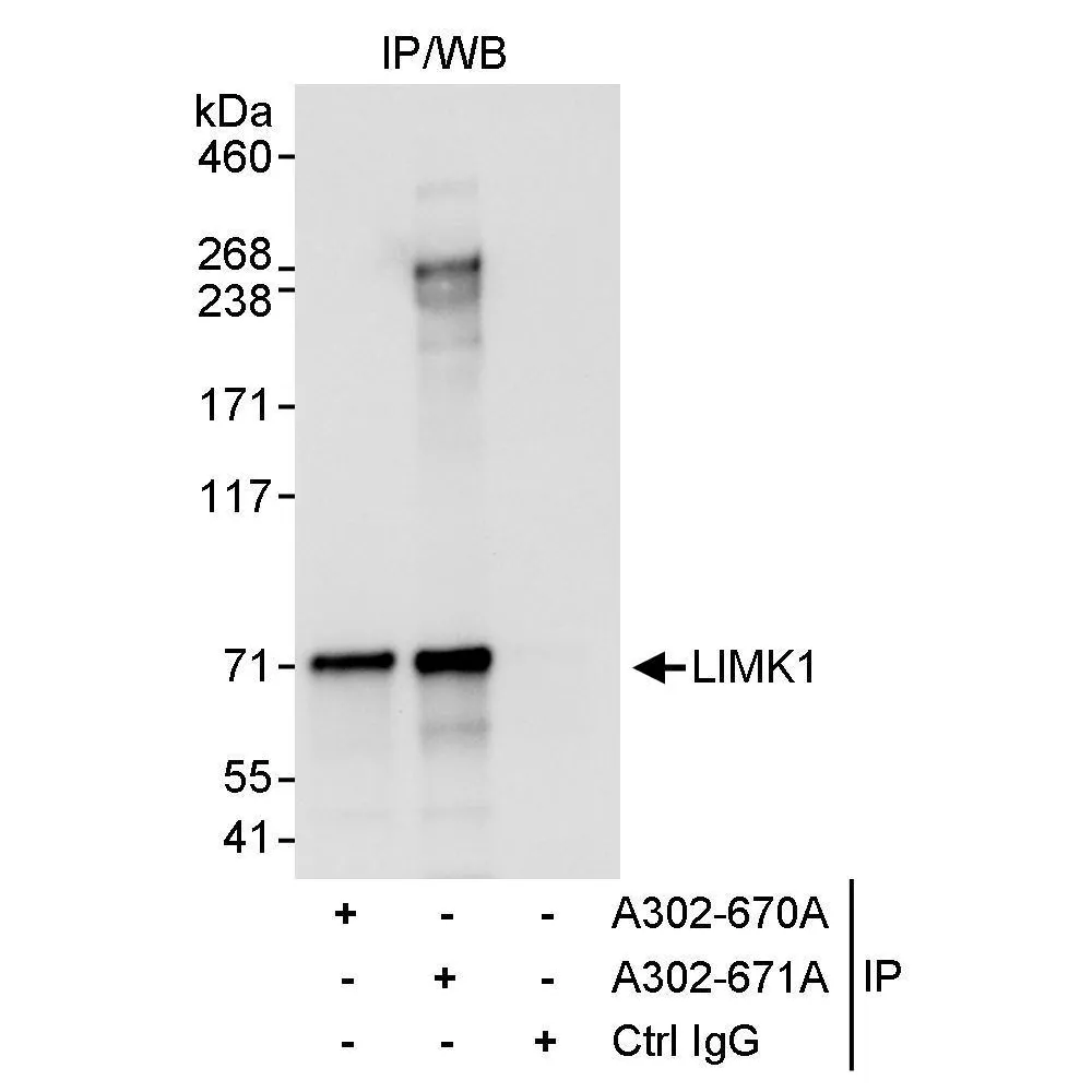 Rabbit anti-LIMK1 Antibody, Affinity Purified