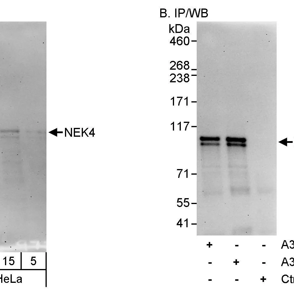 Rabbit anti-NEK4 Antibody, Affinity Purified