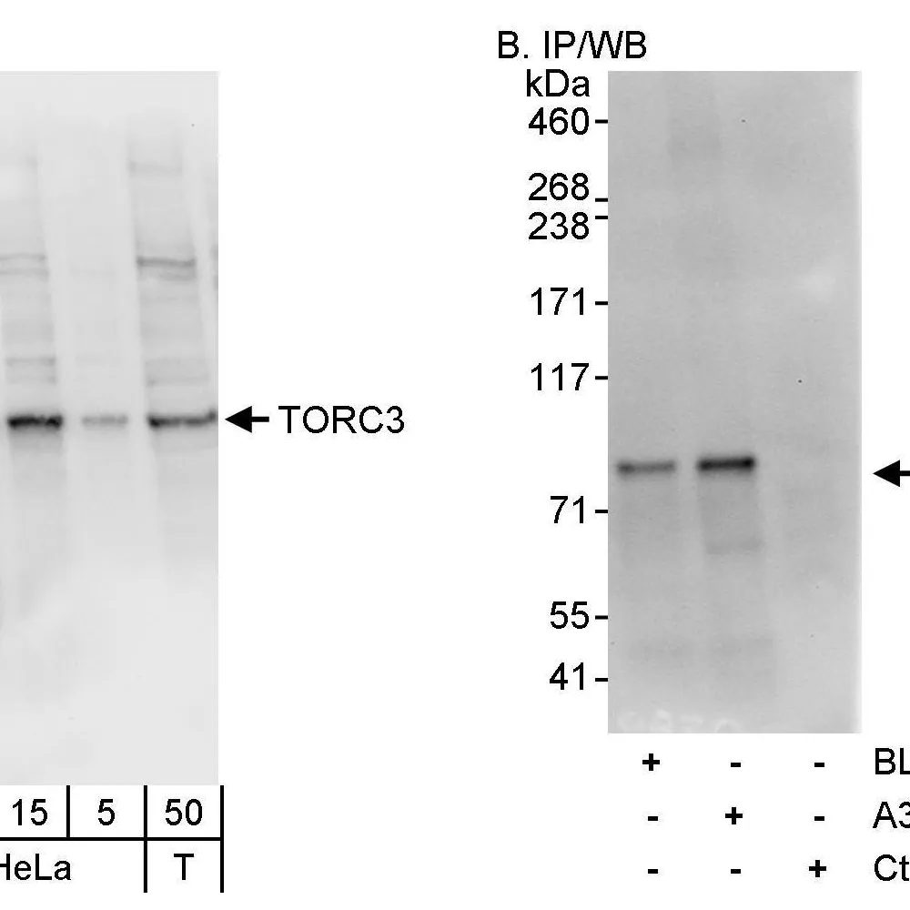 Rabbit anti-TORC3 Antibody, Affinity Purified
