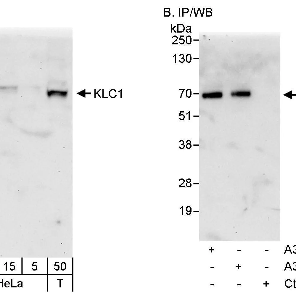 Rabbit anti-KLC1 Antibody, Affinity Purified