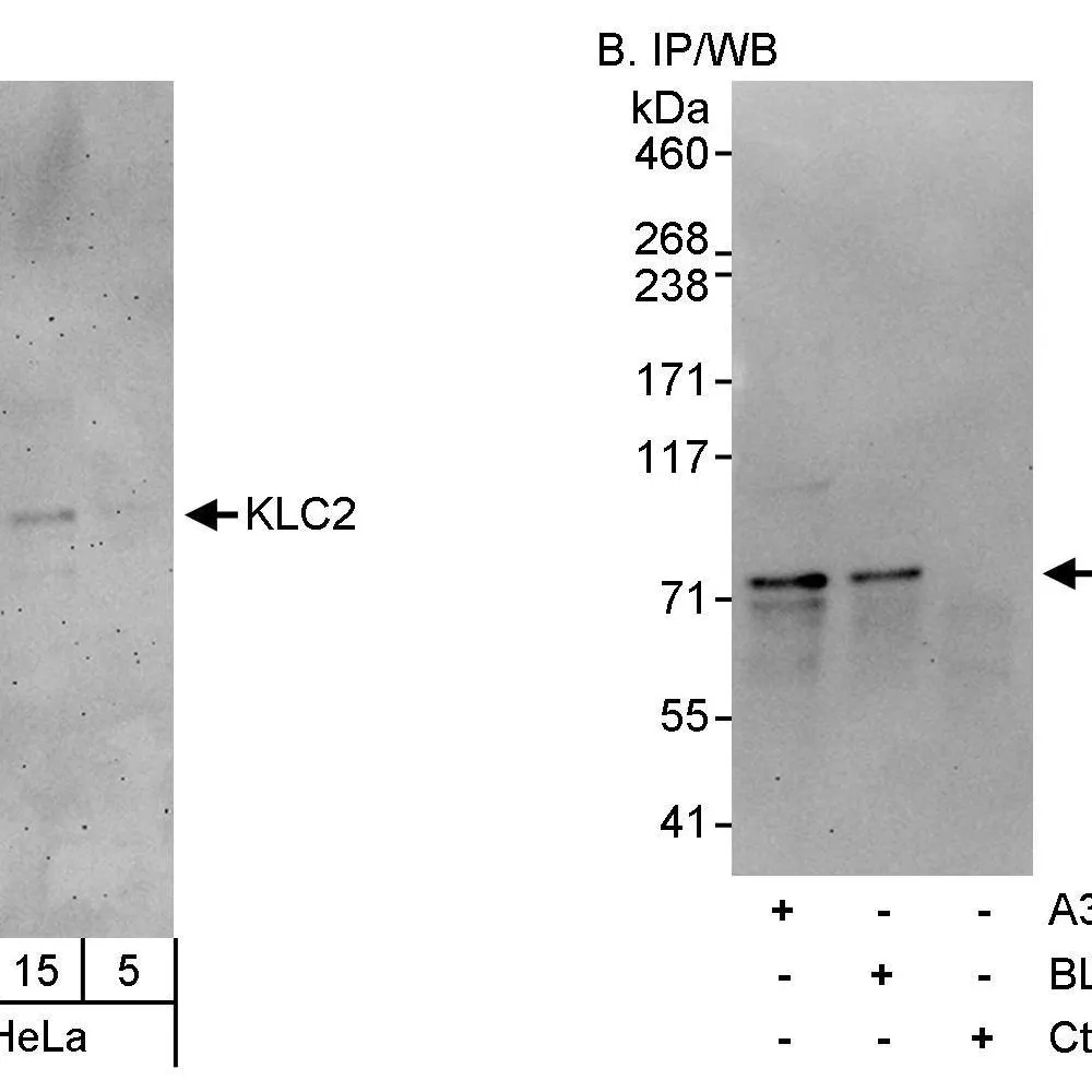 Rabbit anti-KLC2 Antibody, Affinity Purified