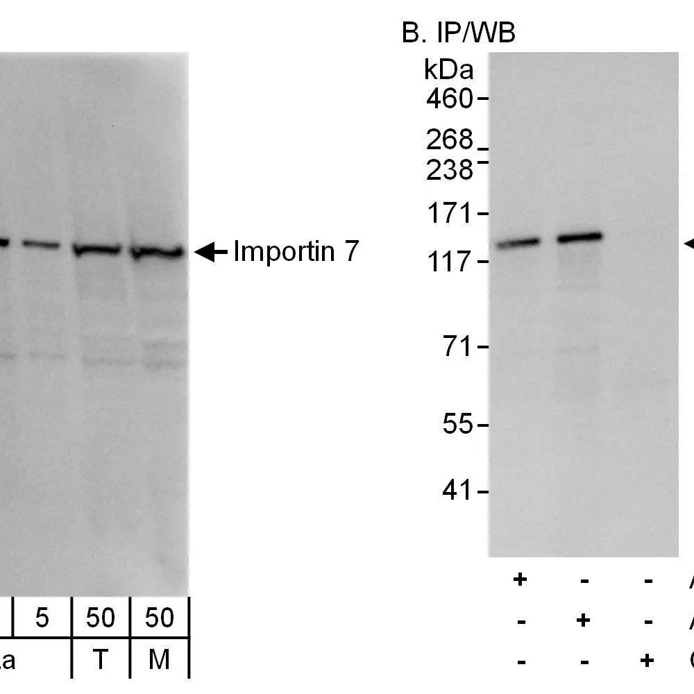 Rabbit anti-Importin 7 Antibody, Affinity Purified