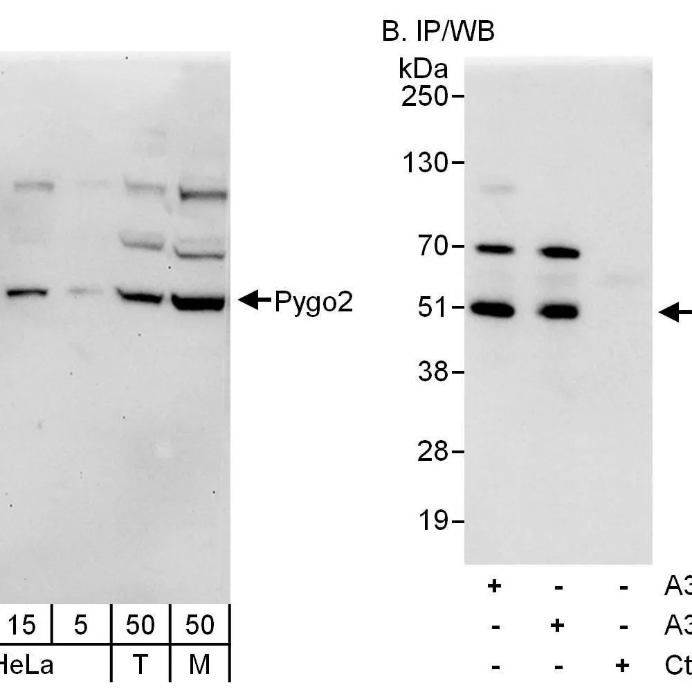 Rabbit anti-Pygo2 Antibody, Affinity Purified