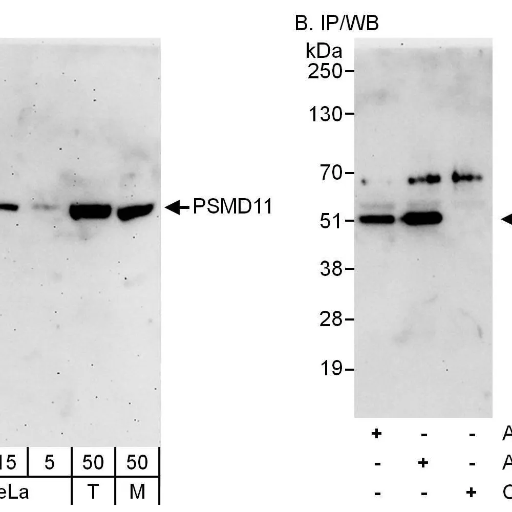 Rabbit anti-PSMD11 Antibody, Affinity Purified