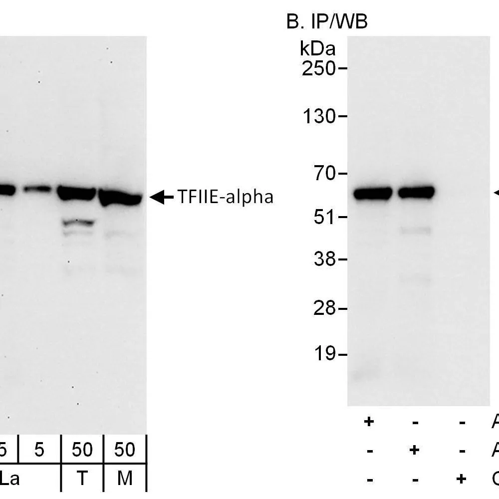 Rabbit anti-GTF2E1/TFIIE-alpha Antibody, Affinity Purified
