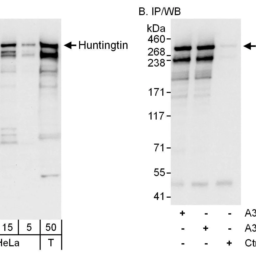 Rabbit anti-Huntingtin Antibody, Affinity Purified
