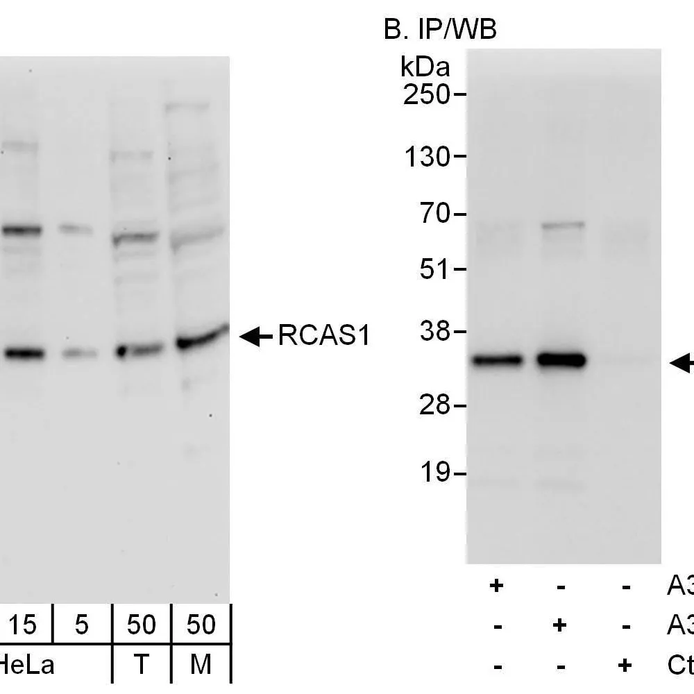 Rabbit anti-RCAS1 Antibody, Affinity Purified