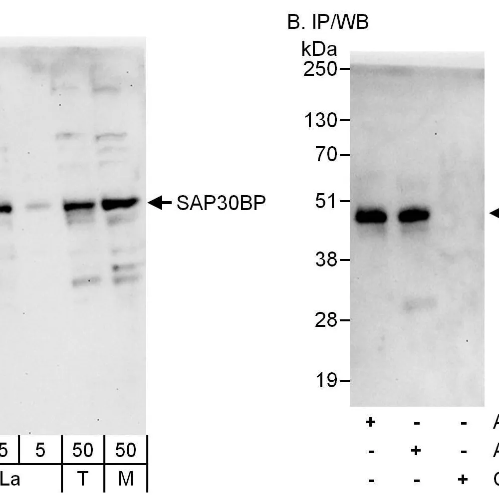 Rabbit anti-SAP30BP Antibody, Affinity Purified