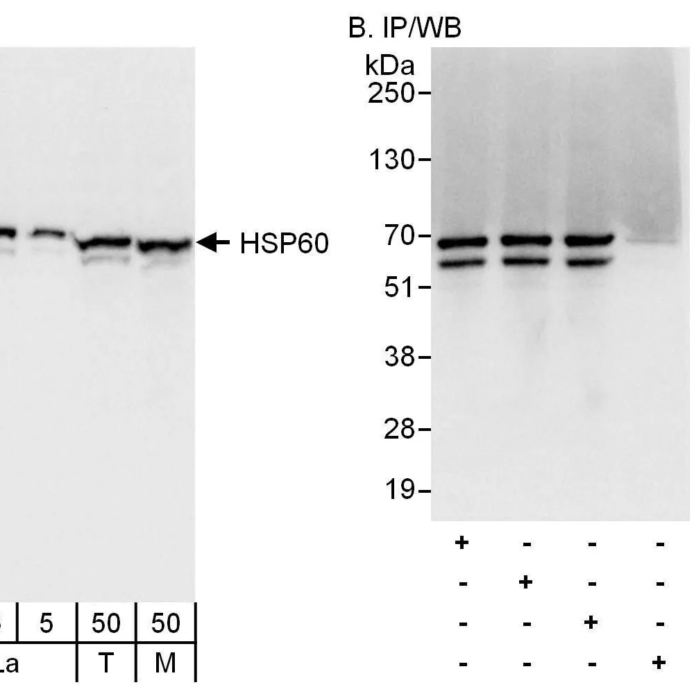 Rabbit anti-HSP60 Antibody, Affinity Purified